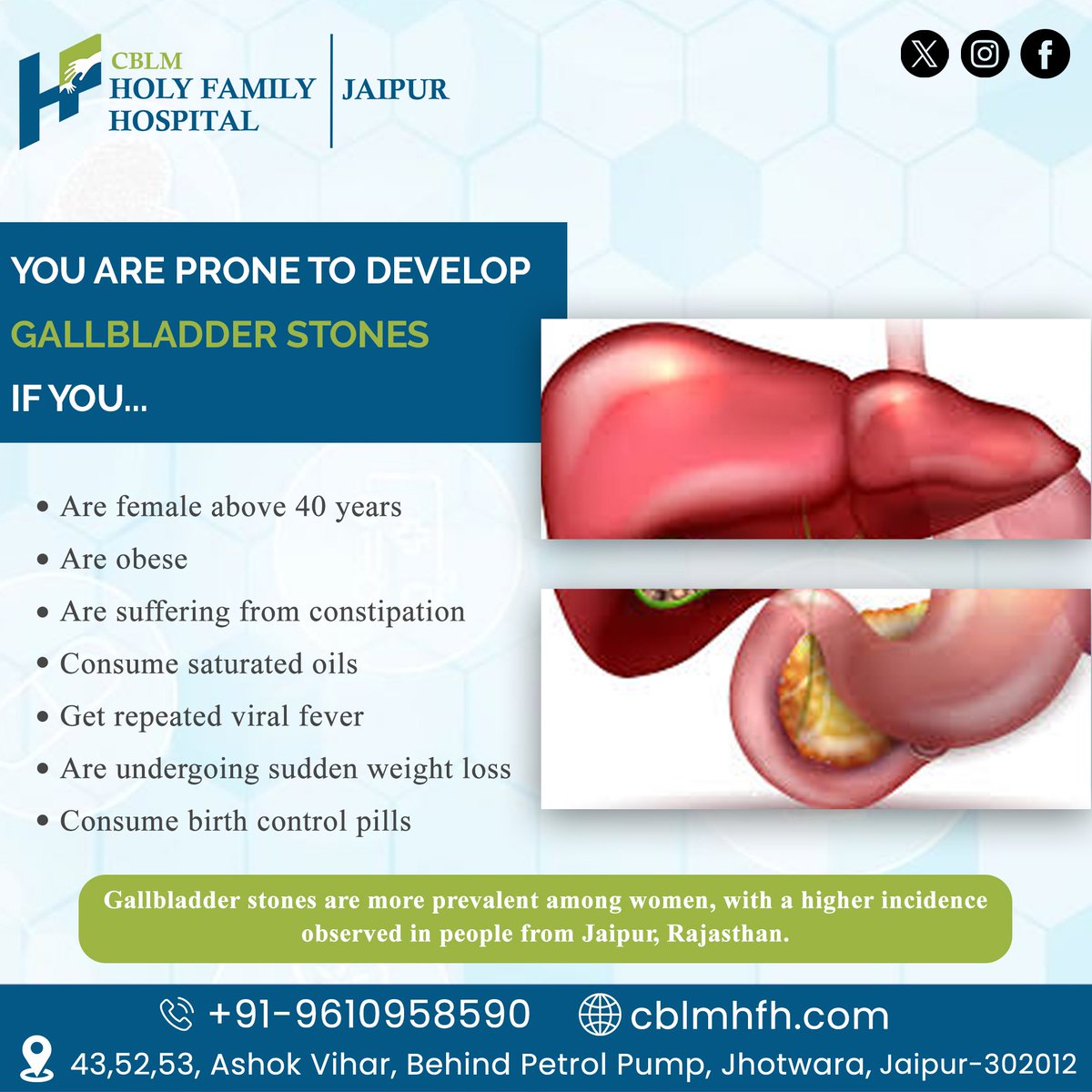 CBLMHFH's tweet photo. #Gallbladderstones risk factors: Female, obese, constipated, high-fat diet, viral fever, weight loss, birth control pills.
For more information: Call us: at +91-9610958590
Visit:- https://t.co/VRYrbzc6NU
#GallbladderHealth #WomenHealth #GallstoneSurgery #Hospital #CBLM #Jaipur https://t.co/3jgGYzllRz