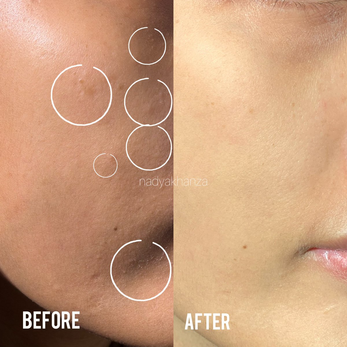nadyakhanza's tweet photo. SIAPA YANG BUCIN MOISTURIZER SKIN GAME?! SAYAAAA 
fix bucin sama kind watery moisturizer skin game.!!

formula barunya tuh gak lengket dan lebih adem👍🏻
sempet kulit kering sampe bruntusan parah langsung reda dibeberapa hari pemakaian😩🫵🏻 https://t.co/kqvPNMQybh