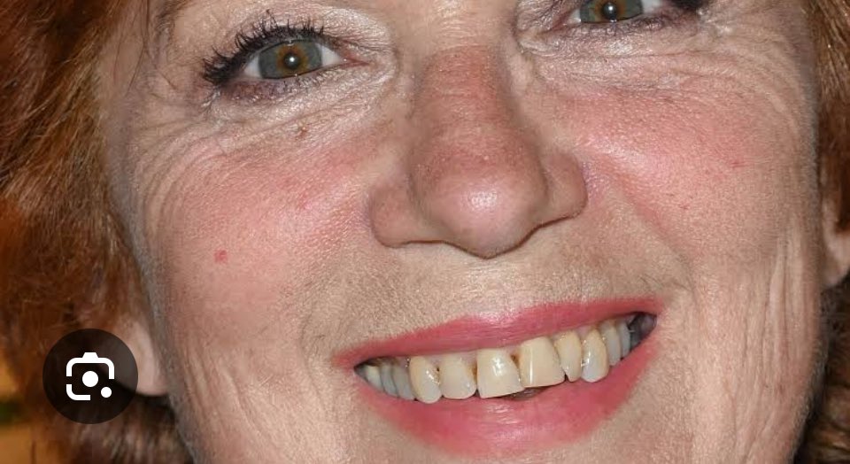 Francedescons's tweet image. oh putain les chicots ?