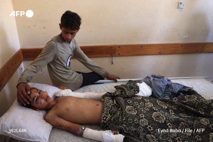 File photo shows an injured Palestinian child lying in a bed at Nasser hospital in Khan Yunis in the southern Gaza Strip on July 3, 2024
