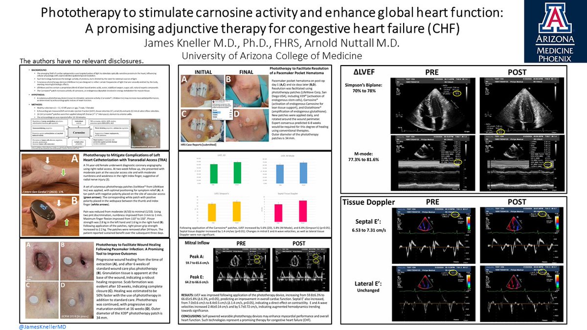 James Kneller, M.D., Ph.D., FHRS (@jamesknellermd) on Twitter photo Will #phototherapy emerge as the next disruptive innovation in cardiovascular science? I enjoyed presenting our results at <a href="/AHAScience/">AHA Science</a> #bcvs2024 Chicago.
<a href="/uazresearch/">University of Arizona Research</a> <a href="/uazmedphx/">UAZ Medicine - Phoenix</a> <a href="/DrRoderickTung/">Roderick Tung</a> #optogenetics #lifewave Will #phototherapy emerge as the next disruptive innovation in cardiovascular science? I enjoyed presenting our results at <a href="/AHAScience/">AHA Science</a> #bcvs2024 Chicago.
<a href="/uazresearch/">University of Arizona Research</a> <a href="/uazmedphx/">UAZ Medicine - Phoenix</a> <a href="/DrRoderickTung/">Roderick Tung</a> #optogenetics #lifewave