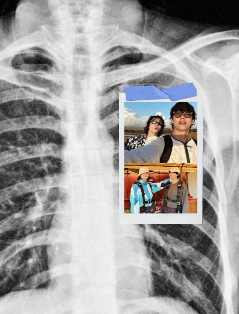 jungkovtae's tweet image. 𑁤