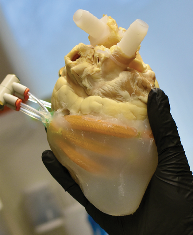 Professor Ellen Roche and her team have developed a soft robotic biohybrid heart and computational fluid models to support valve assessment for Tetralogy of Fallot, a heart defect in newborns.