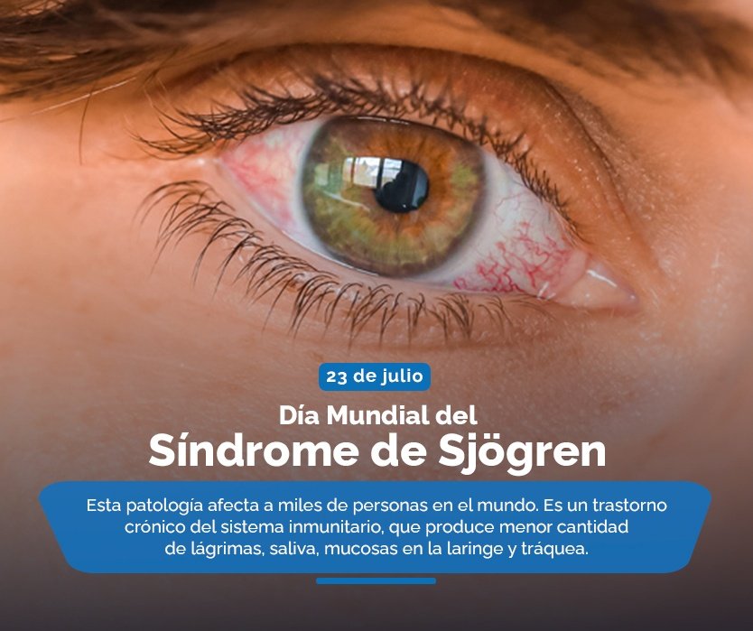 GNB_SLCCT's tweet photo. #23Jul Día Mundial del Síndrome de Sjögren 👁️ https://t.co/Pt8s1FzIt4
