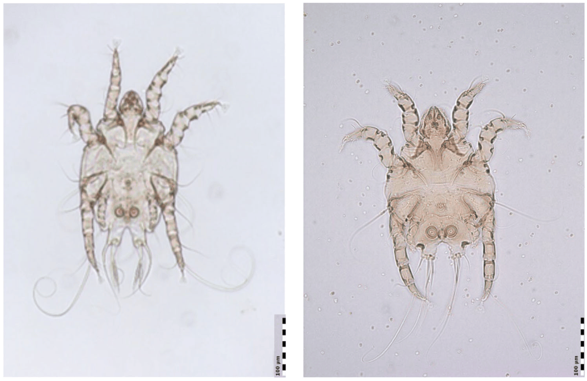 DiversityMDPI's tweet photo. 🪳Expand your knowledge
🔍Is Chorioptes texanus to Displace Chorioptes bovis? Notes on the Mites Causing Bovine Chorioptic Mange in Central Europe
🐄by Rehbein and Visser
Article Views 791
#VeterinaryScience #MiteResearch #BovineHealth #entomology
🌍https://t.co/l2NIcdFj6w https://t.co/TIu5z0NF1R