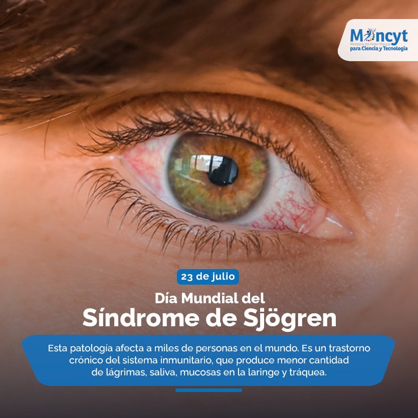 #Efemérides #23Jul  Día Mundial del Síndrome de Sjögren 👁️ #AfirmativosYPaLante #Infocentroaldía