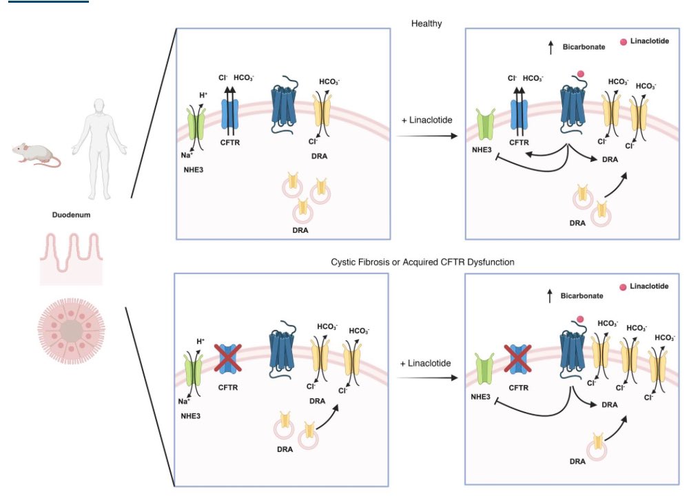 CFmdphd's tweet photo. In the latest issue of @JCI_insight
👉Linaclotide stimulates #intestine #bicarbonate secretion, in health and #CF
👉DRA (SLC26A3) expression in human duodenum
👉#CFTR inhibition, #cysticfibrosis, and #linaclotide increase DRA trafficking in #enteroids
https://t.co/syF0ieFgSK https://t.co/sMNrAfNkER