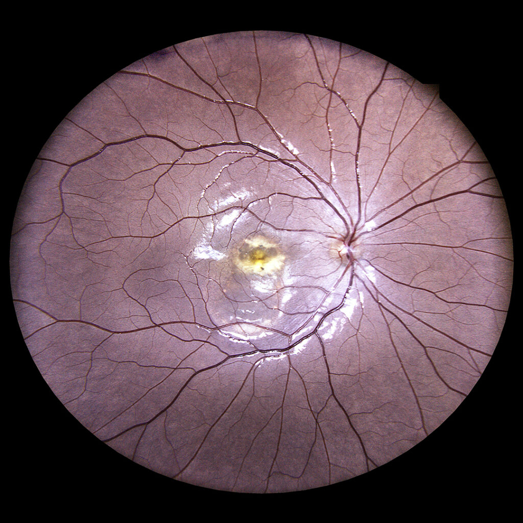 Discover the Power of iCare EIDON! Dive into our latest case studies showcasing the incredible impact of iCare EIDON in eye care. From innovative diagnostics to transformative patient outcomes, see how we’re revolutionizing vision care. icare-world.com/case-studies-w… #retina #icareeidon