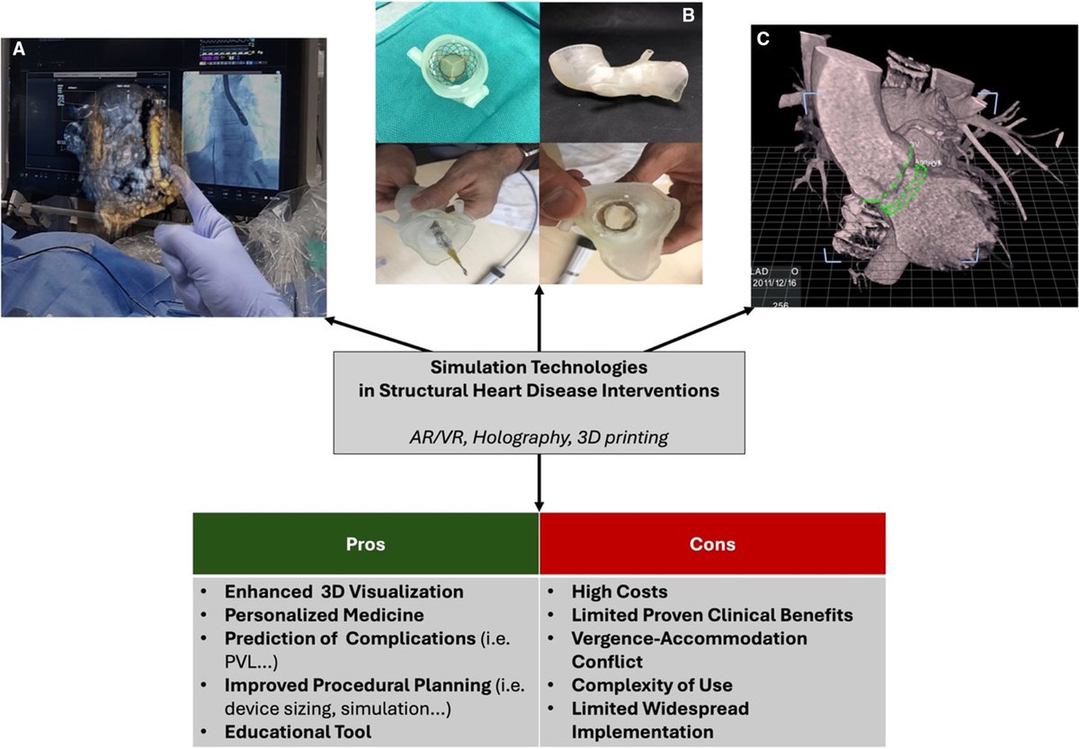 Joseph Kassab (@jkassabmd) on Twitter photo What are the current simulation technologies in structural heart disease interventions? Read below 👇🏻
<a href="/SergeHarbMD/">Serge C. Harb</a> <a href="/CleClinicHVTI/">Cleveland Clinic Heart, Vascular & Thoracic</a> <a href="/JAHA_AHA/">JAHA</a>
ahajournals.org/doi/10.1161/JA… What are the current simulation technologies in structural heart disease interventions? Read below 👇🏻
<a href="/SergeHarbMD/">Serge C. Harb</a> <a href="/CleClinicHVTI/">Cleveland Clinic Heart, Vascular & Thoracic</a> <a href="/JAHA_AHA/">JAHA</a>
ahajournals.org/doi/10.1161/JA…