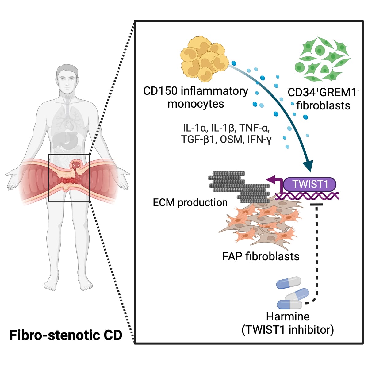 Gianluca Matteoli (@gmatteoli1978) on Twitter photo Our study "Intercellular interaction between FAP+ fibroblasts and CD150+ inflammatory monocytes mediates fibrostenosis in Crohn’s disease" is out jci.org/articles/view/… with first authors <a href="/kebojun/">Bo-Jun Ke</a> and <a href="/saeedfc/">Saeed</a> in collaboration with <a href="/SeverineVermei1/">Severine Vermeire</a> and the <a href="/ibdleuven/">IBD Leuven</a> team Our study "Intercellular interaction between FAP+ fibroblasts and CD150+ inflammatory monocytes mediates fibrostenosis in Crohn’s disease" is out jci.org/articles/view/… with first authors <a href="/kebojun/">Bo-Jun Ke</a> and <a href="/saeedfc/">Saeed</a> in collaboration with <a href="/SeverineVermei1/">Severine Vermeire</a> and the <a href="/ibdleuven/">IBD Leuven</a> team