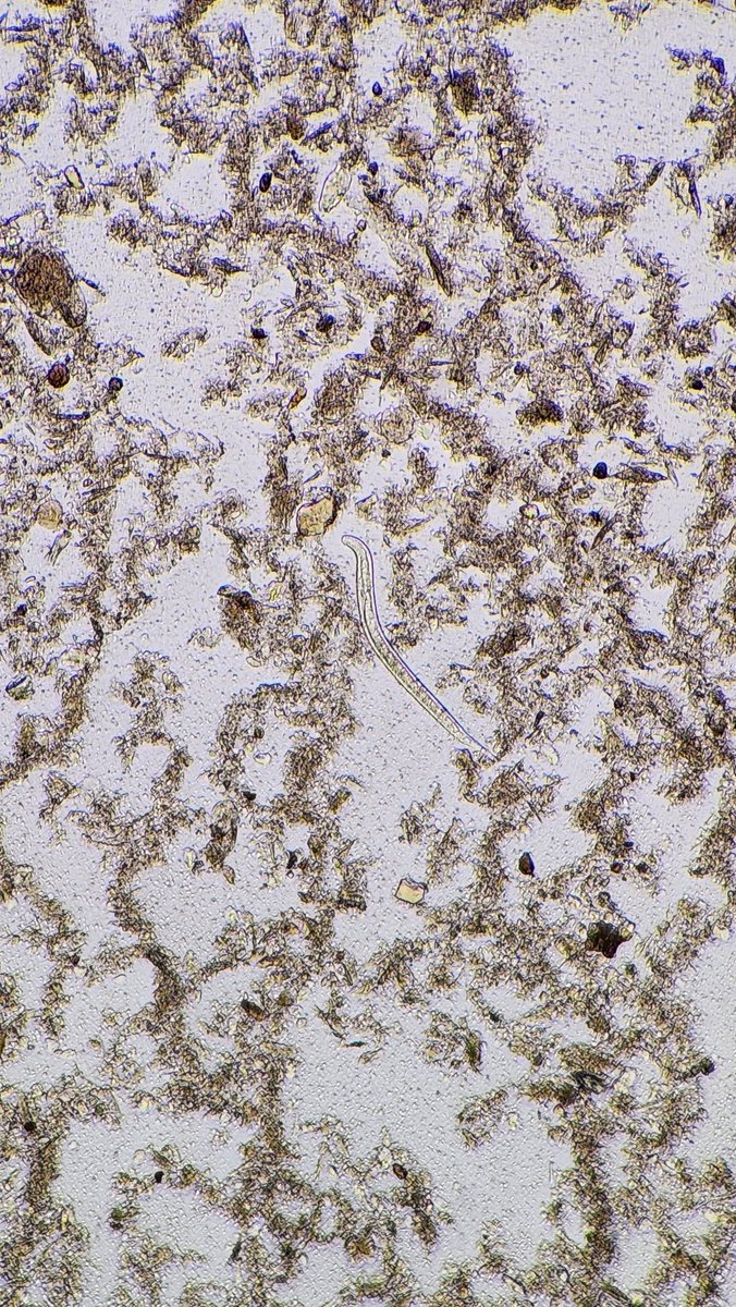 Just another stool, another Strongyloides L1 larvae. 🪱
#parasitology
<a href="/ARUPLabs/">ARUP Laboratories</a> <a href="/ParasiteGal/">Bobbi Pritt, MD</a>