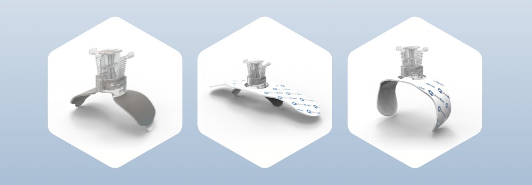 ForgeMedical's tweet photo. Say goodbye to traditional balloon bands and hello to #VasoStat, the advanced solution for achieving hemostasis quickly &amp; effectively. Here are some of the key benefits:
🔹 Faster Hemostasis
🔹Increased Comfort
🔹 Precision Pressure Control: 
🔹 Reduced Complications https://t.co/dL3qvrqEuT