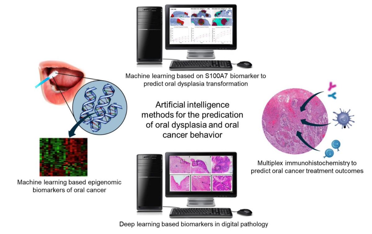 Simon Young (@siwyoung) on Twitter photo Just accepted - "Artificial Intelligence Applications in Oral Cancer and Oral Dysplasia" with <a href="/drchiviet/">C. Viet DDS, MD, PhD, FACS</a> et al. in Tissue Eng Part A. Very excited to see how machine learning will enhance our ability to predict the behavior of oral dysplasia and cancer! tinyurl.com/yud4hrmc Just accepted - "Artificial Intelligence Applications in Oral Cancer and Oral Dysplasia" with <a href="/drchiviet/">C. Viet DDS, MD, PhD, FACS</a> et al. in Tissue Eng Part A. Very excited to see how machine learning will enhance our ability to predict the behavior of oral dysplasia and cancer! tinyurl.com/yud4hrmc