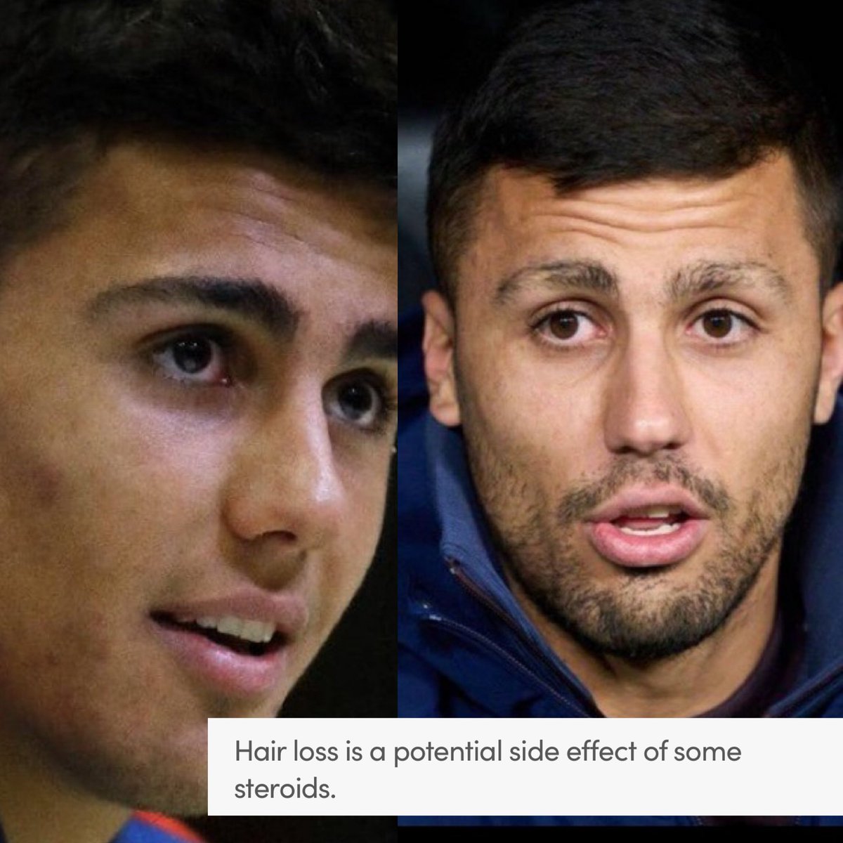 Rodri before and after he joined Manchester City 🤔🤔🤔 #Roidri