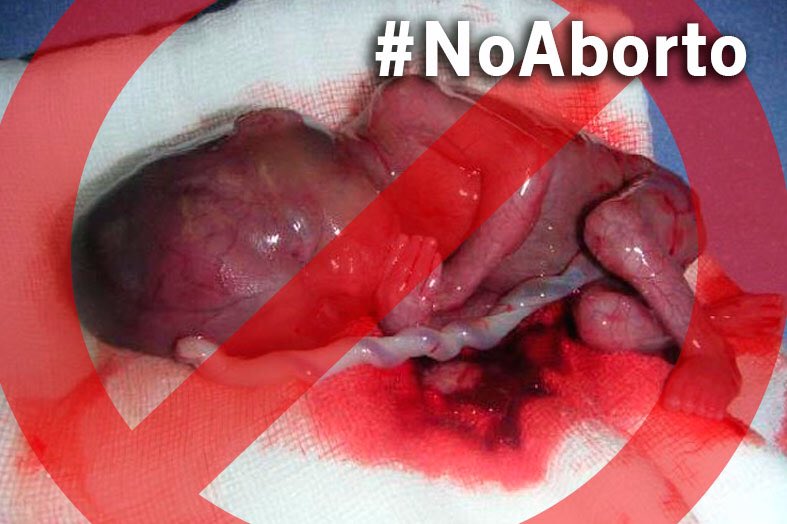 pipperpaldy's tweet photo. @ObispoMunilla ¿Del aborto cuándo hablamos? @Pontifex_es
@ObispoMunilla
@jmgilt
@OmellaCardenal
@archimadrid https://t.co/2GGHXeFOpI