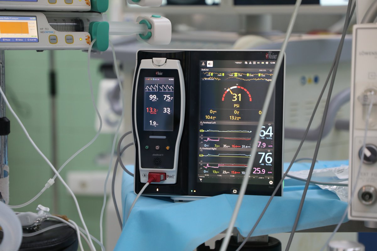 AxmedElkmeshi's tweet photo. Scenes from Ali Omer Asker’s Neuroanesthesia Workshop on Total Intravenous Anesthesia and Full Brain Function Monitoring (Depth of Anesthesia + NIRS Cerebral Oximetry) … a leading local hospital in the field of Neurosurgery. https://t.co/suJ5LGNtkm