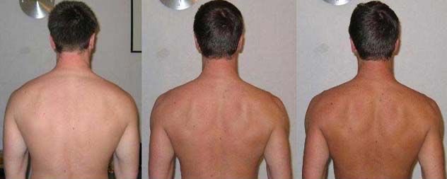 thecaptain_nemo's tweet image. always surprised how few people know about Melanotan II, a drug that effectively allows you to darken your skin color at will without any sun exposure

also has a weird side effect of causing spontaneous and sometimes painful erections