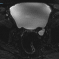 Marcelo Wroclawski tweet media