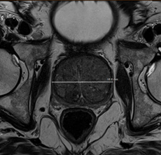Marcelo Wroclawski tweet media