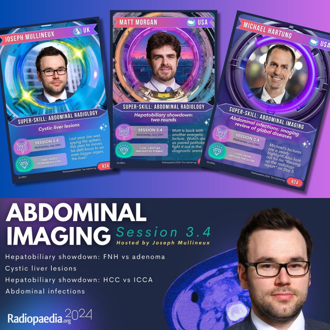 Sal Ayesa (@salayesa) on Twitter photo Coming up in 1 hour at UTC 1200 <a href="/JosephMullineux/">Joe Mullineux</a> hosts @MP_Hartung & <a href="/matt_m0rgan/">matt_m0rgan</a> for the advanced abdominal imaging session! Day 3 at #Radiopaedia2024 keeps getting better!
Come join us! <a href="/Radiopaedia/">Radiopaedia.org</a> <a href="/murf1990/">Andrew Murphy</a> <a href="/francisdeng/">Francis Deng, MD</a> <a href="/DrVikasShah/">(ππππ‘πππ’ππππππ)</a> <a href="/DrAndrewDixon/">Andrew Dixon</a> Coming up in 1 hour at UTC 1200 <a href="/JosephMullineux/">Joe Mullineux</a> hosts @MP_Hartung & <a href="/matt_m0rgan/">matt_m0rgan</a> for the advanced abdominal imaging session! Day 3 at #Radiopaedia2024 keeps getting better!
Come join us! <a href="/Radiopaedia/">Radiopaedia.org</a> <a href="/murf1990/">Andrew Murphy</a> <a href="/francisdeng/">Francis Deng, MD</a> <a href="/DrVikasShah/">(ππππ‘πππ’ππππππ)</a> <a href="/DrAndrewDixon/">Andrew Dixon</a>