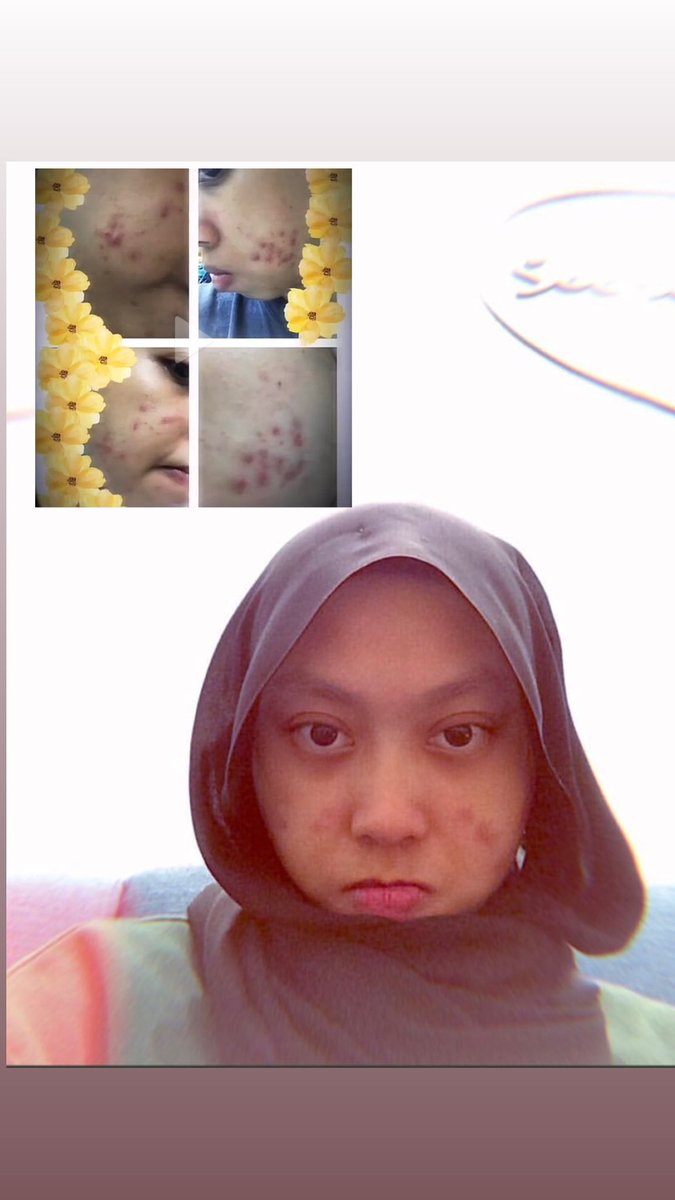 coffeeorcola's tweet photo. A thread of my updated skincare routine. As per request.

Skincare focus more on soothing, maintaining breakout-free skin, &amp; anti-aging; umur rahsia 🤡

I have sensitive, combination-prone-to-dry skin for reference. https://t.co/waL786ckyq