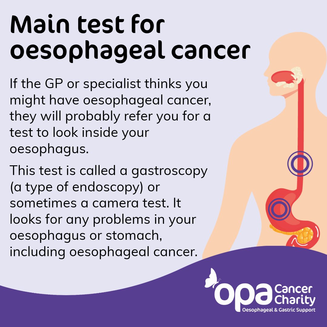 OPA_UK's tweet photo. Main test for oesophageal cancer

#opa #cancer #charity #OesophagealCancer #Oesophagus #OesophagealCancerAwareness

This information is extracted from NHS. https://t.co/QPWarQyvJp