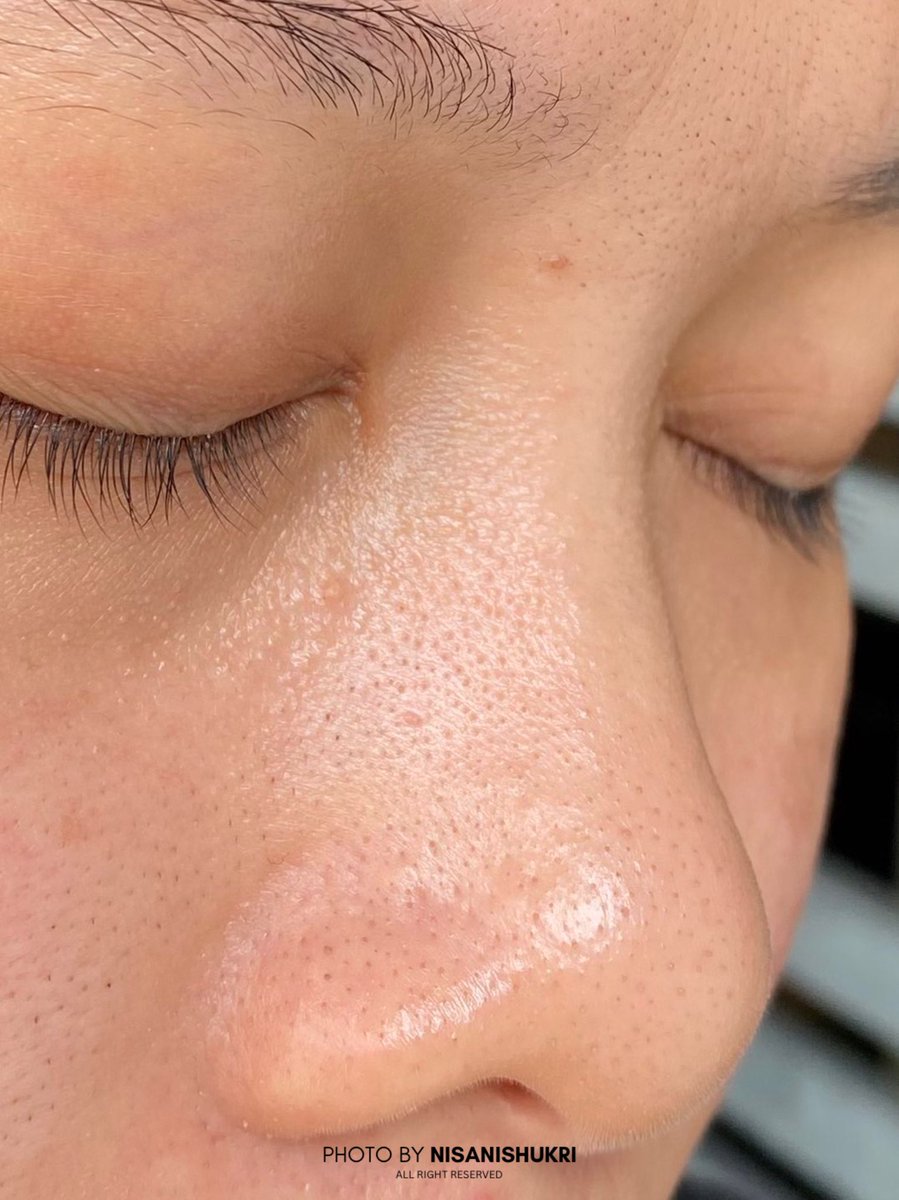 I tak sangka hidung i slowly bersih from blakchead and clogged pores after use this one toner!

Before                                    After