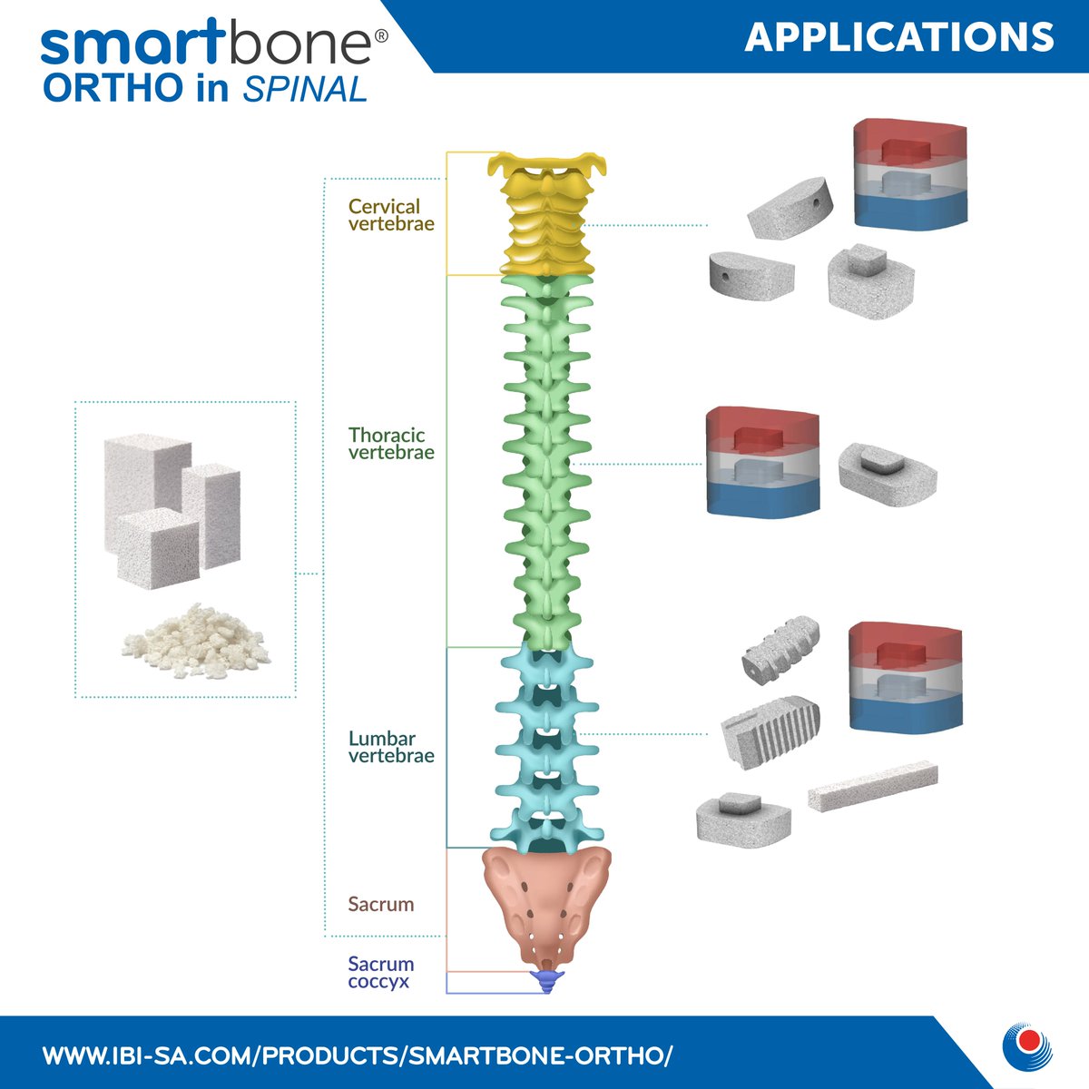 smartboneibi's tweet image. SmartBone® is the perfect #bone #substitute for #stabilizing the spine and facilitating spinal #fusion.
Its unique properties, make it highly effective in supporting complex spinal fusion surgeries by promoting #integration and ensuring a stable, long-lasting fusion.