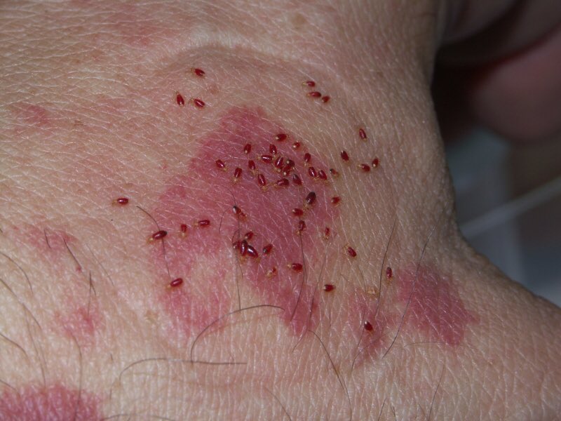 iweenshares's tweet photo. Kalau badan korang tiba2 naik merah, gatal merenyam tu this might be the culprit 🤮

High possibility tilam korang dah infested dengan pepijat atau bed bugs! 

Please do something quick sebelum dia merebak-YUCK! https://t.co/T7ztxR2f1T