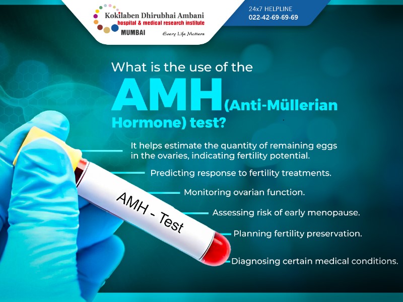 KDAHMumbai's tweet image. The AMH test assesses egg reserve crucial for fertility. Egg production declines with age. If you are over 30 and struggling to conceive, check AMH levels. Connect with experts today! Call 022 4269 6969 or visit kokilabenhospital.com #AMHTest #Fertility #ReproductiveHealth