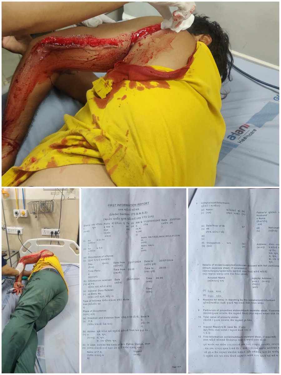 kajal_jaihind's tweet image. गुजरात के #कच्छ में बढ़ती इस्लामिक आक्रामकता-
 “विश्व हिंदू परिषद” के गौ रक्षक पर Gहादीयो ने किया जानलेवा हमला।

22/07/2024 की शाम 8 बजे #भुज में विश्व हिंदू परिषद के कार्यकर्ता #भावेश_परमार पर Gहादी #मोहम्मद_निज़ाम और Gहादी #इरफ़ान_ब्लॉच ने जान से मारने के सुनियोजित षडियंत्र के…