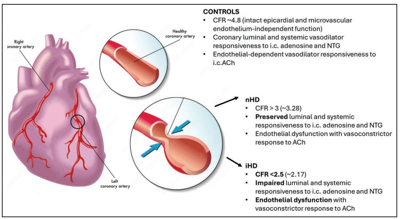 Chris Chan (@chrischanuhn) on Twitter photo We gained cardiovascular insights from intensive hemodialysis. Our team now reports the differences in coronary responsiveness amongst nocturnal and conventional hemodialysis. <a href="/UHN/">University Health Network</a> <a href="/SinaiHealth/">Sinai Health</a> <a href="/HyperAHA/">Hypertension</a>
ahajournals.org/doi/10.1161/HY… We gained cardiovascular insights from intensive hemodialysis. Our team now reports the differences in coronary responsiveness amongst nocturnal and conventional hemodialysis. <a href="/UHN/">University Health Network</a> <a href="/SinaiHealth/">Sinai Health</a> <a href="/HyperAHA/">Hypertension</a>
ahajournals.org/doi/10.1161/HY…