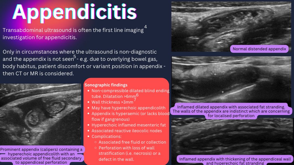 (𝚝𝚑𝚎𝚡𝚛𝚊𝚢𝚍𝚘𝚌𝚝𝚘𝚛) (@drvikasshah) on Twitter photo It's now the rPoster session on day 3 of #Radiopaedia2024.
This is a richly illustrated poster on bowel ultrasound by <a href="/IbiHasan/">Ibtisam Hasan</a> and Fatma Eminaga.
Lots of tips on how to get the best images, and appearances of various bowel diseases. It's now the rPoster session on day 3 of #Radiopaedia2024.
This is a richly illustrated poster on bowel ultrasound by <a href="/IbiHasan/">Ibtisam Hasan</a> and Fatma Eminaga.
Lots of tips on how to get the best images, and appearances of various bowel diseases.