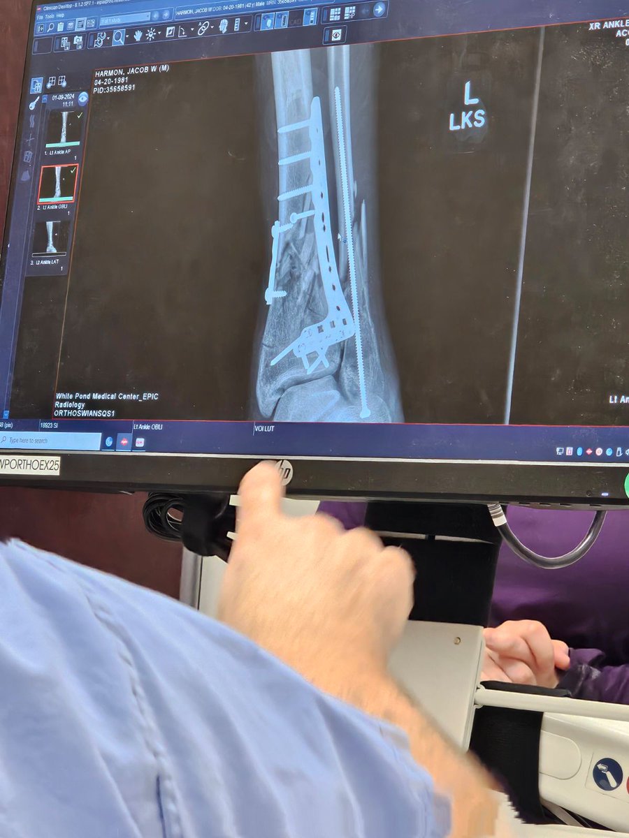 What the hell can't I ever get sometype of assistance I busted my ass all my life and the first time I suffered a injury where I can't do anything I've never asked for anything now I'm 7 months in a injury no income and no relief in sight I just wish I could walk so I can work