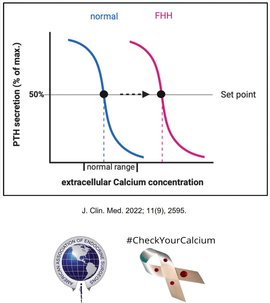 TheAAES's tweet image. Familial Hypocalciuric Hypercalcemia (FHH) is a rare disorder of the calcium-sensing receptor gene that causes high blood calcium levels and very low urine calcium levels. It can be confused for primary hyperparathyroidism and does not require treatment. #PAM2024 @ParaTroupers1