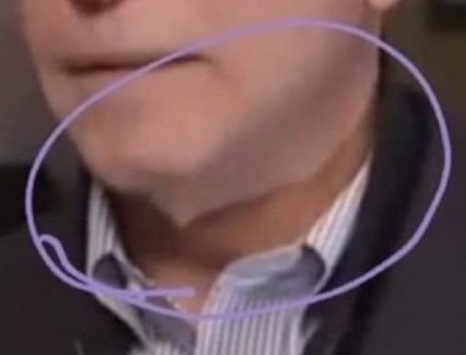 SeeTheBigDipper's tweet photo. 💥 You are right @DonCour93737228 not all masks go down to their shoulders.
#SkinMask https://t.co/CZcPlJcKrV