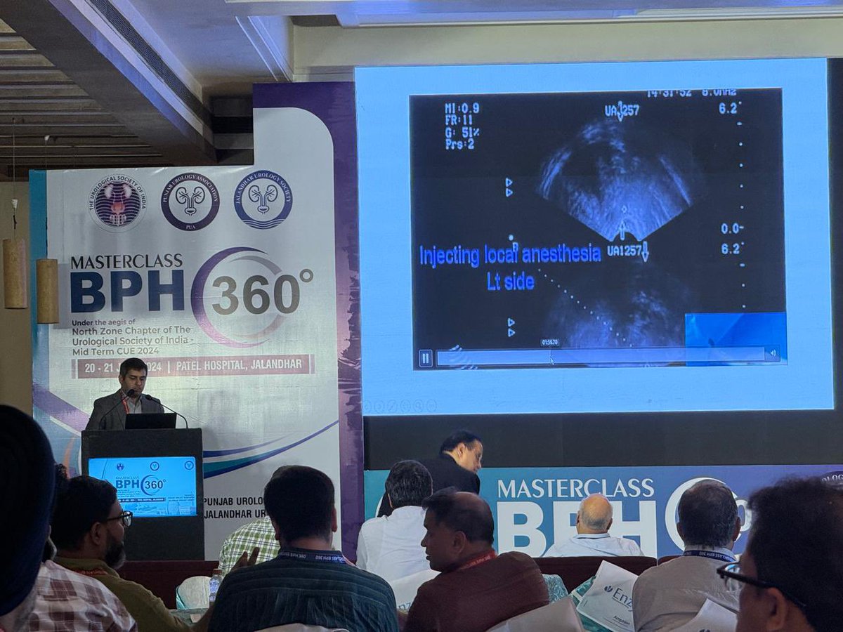 Had an amazing time at the midterm CME of <a href="/nzusioffice/">North Zone Chapter of Urological Society of India</a> in Jalandar. Grateful to have been able to show a Semi-Live Video of free hand Transrectal Prostate Biopsy. <a href="/usioffice/">Urological Society of India 🇮🇳</a> <a href="/YouthUSI/">YOUsi</a>