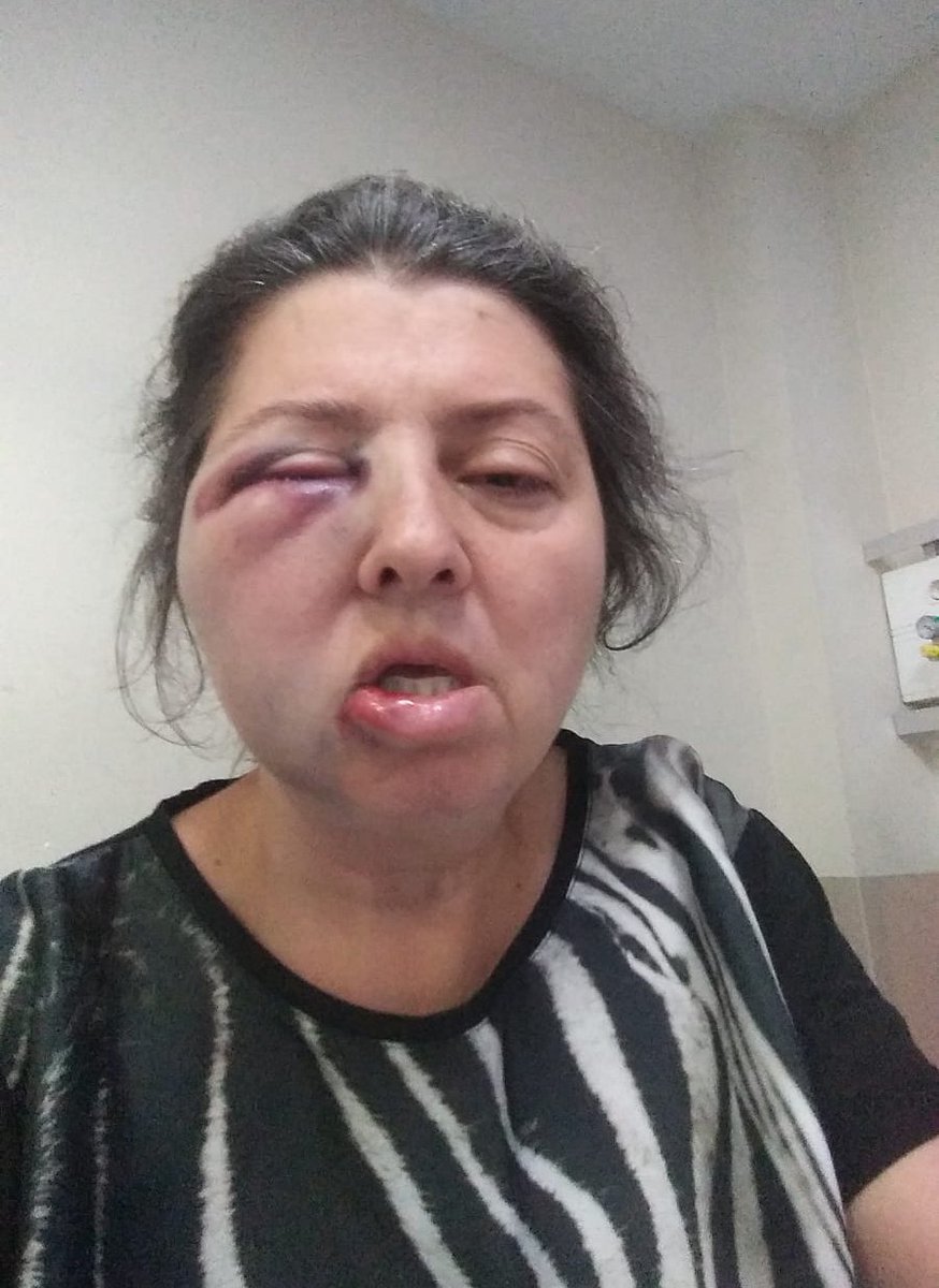 MediOzkan20's tweet photo. VAHŞET ❗️Nilüfer ve Nilgün Tanca kardeşler apartman bahçesine sığınmış sakat ve yavru kedileri besledikleri için komşuları S.D ve oğulları tarafından öldüresiye dövüldüler. Bana ulaşıp yardım istediler. Durumları ağır. Değerli avukatlarımızdan acil hukuki destek rica ediyorum. https://t.co/3H9ukRnRlb