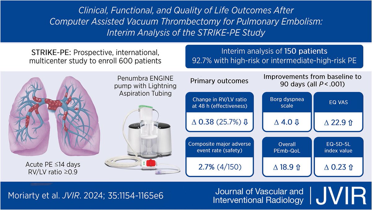 John Moriarty (@jonnymoriarty) on Twitter photo STRIKE-PE trial data drop: Impressive improvements in QOL post PE-intervention. Thx patients and investigators on 3 continents, more to come soon! sciencedirect.com/science/articl…. <a href="/JVIRmedia/">JVIR</a> <a href="/SIRspecialists/">Society of Interventional Radiology</a> <a href="/PERTConsortium/">PERT Consortium</a> <a href="/uclaVIR/">UCLA IR</a> <a href="/UCLAPulmVasc/">UCLA Pulmonary Vascular Disease Program</a> <a href="/UCLAHealth/">UCLA Health</a> STRIKE-PE trial data drop: Impressive improvements in QOL post PE-intervention. Thx patients and investigators on 3 continents, more to come soon! sciencedirect.com/science/articl…. <a href="/JVIRmedia/">JVIR</a> <a href="/SIRspecialists/">Society of Interventional Radiology</a> <a href="/PERTConsortium/">PERT Consortium</a> <a href="/uclaVIR/">UCLA IR</a> <a href="/UCLAPulmVasc/">UCLA Pulmonary Vascular Disease Program</a> <a href="/UCLAHealth/">UCLA Health</a>