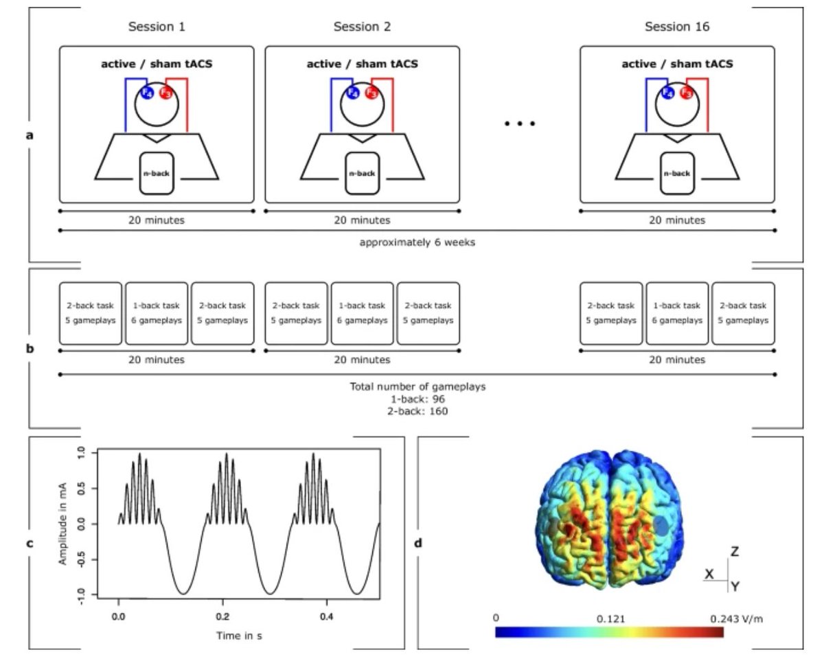 GeroScienceAGE's tweet photo. 📢New Open🔓Access Paper
Boosting working memory in the elderly: driving prefrontal theta–gamma coupling via repeated neuromodulation by Lukas Diedrich & Andrea Antal et al.
https://t.co/nSLn3yyQQ5
#workingmemory #transcranialalternatingcurrentstimulation #crossfrequencycoupling
#cognition #Aging #elderly