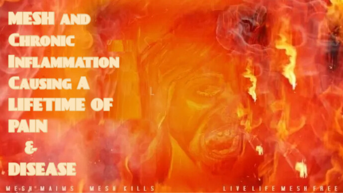 JanUrban12's tweet image. Worldwide there is so much pain and suffering to Men and Women from a Mesh Implant that went Terribly WRONG that has turned Their Bodies into a Torture Chamber of Horrors 4Life. #MeshMaims #MeshKills How does this not Disturb Any One? #LivesInCrisis