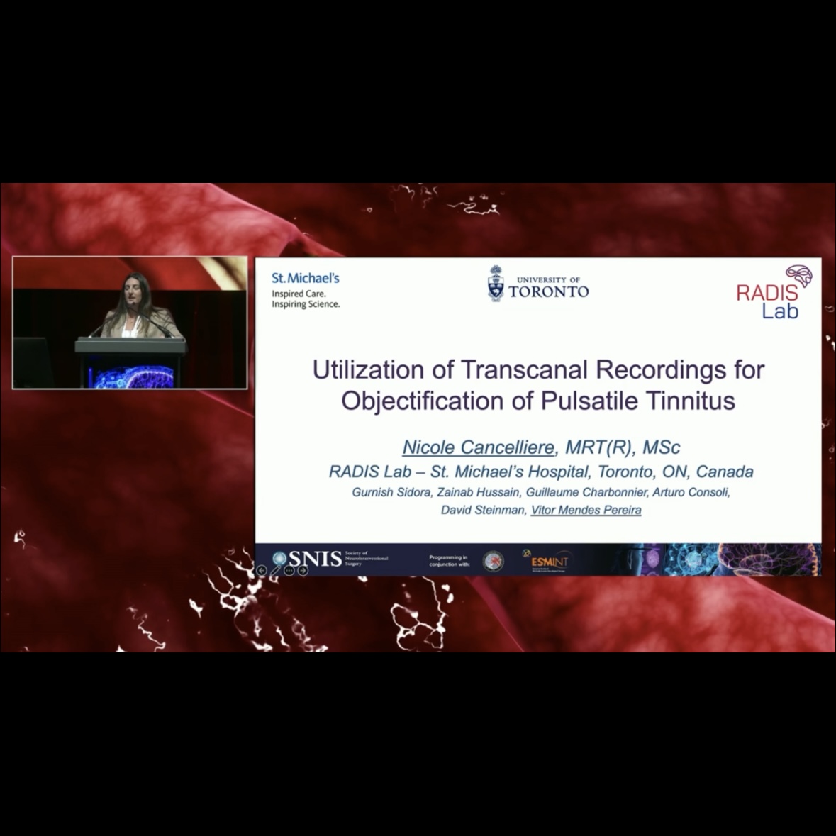 JNIS (@jnis_bmj) on Twitter photo <a href="/NMCancelliere/">Nicole Cancelliere</a> discussing an interesting objective diagnostic modality of transcanal recordings for pulsatile tinnitus #SNIS2024 @SNISInfo <a href="/esmintsociety/">ESMINT Society</a> <a href="/cvsection/">CV Section</a> <a href="/fcalbuquerque51/">Felipe C. Albuquerque</a> @cruzcerebri @mariapanrad <a href="/DanniDiestro/">Dr. DiestroKE</a> <a href="/MattAmansMD/">Matthew Amans</a> <a href="/ducruetaf/">Andrew Ducruet</a> <a href="/MattFusco_MD/">Matt Fusco</a> <a href="/DrAltschul/">Dorothea Altschul MD FAHA FSVIN</a> <a href="/NMCancelliere/">Nicole Cancelliere</a> discussing an interesting objective diagnostic modality of transcanal recordings for pulsatile tinnitus #SNIS2024 @SNISInfo <a href="/esmintsociety/">ESMINT Society</a> <a href="/cvsection/">CV Section</a> <a href="/fcalbuquerque51/">Felipe C. Albuquerque</a> @cruzcerebri @mariapanrad <a href="/DanniDiestro/">Dr. DiestroKE</a> <a href="/MattAmansMD/">Matthew Amans</a> <a href="/ducruetaf/">Andrew Ducruet</a> <a href="/MattFusco_MD/">Matt Fusco</a> <a href="/DrAltschul/">Dorothea Altschul MD FAHA FSVIN</a>