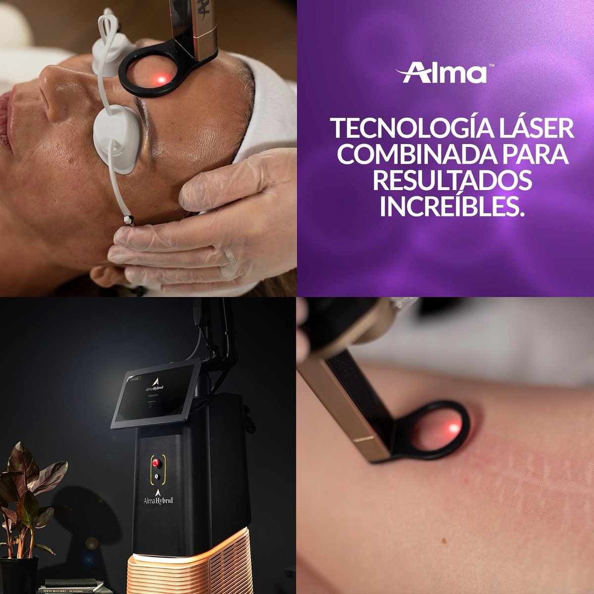 CaliLaser's tweet photo. ¿Ya conoces Alma Hybrid?
Es la última tecnologia para tratamientos de rejuvenecimiento facial y cicatrices. Combina 3 energías en 1 plataforma: láser de CO2 + Impact + láser erbium 1570.
Un tratamiento no invasivo para la piel con resultados visibles desde la primera sesion. https://t.co/Uu3zdQPfgE