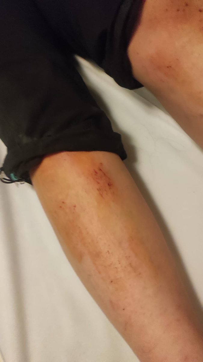 Bursa, İnegöl Sungurpaşa köyünde sokak hayvanlarına bakan bir aileye yönelik, sokak hayvanlarını beslemeleri sebebiyle saldırı oldu. Sokak hayvanlarına sahip çıkan anne ve kızı komşuları tarafından darp edilmiş, besledikleri bir kedi katledilmiş. Henüz yasa yürürlülüğe geçmeden