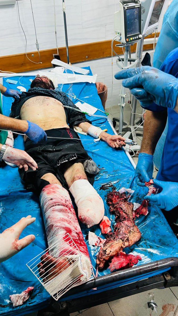 BekirTiryakii's tweet photo. Netanyahu'nun ABD Kongresi'nde konuştuğu ve ABD kongresinin onu alkışladığı saatlerde,İsrail işgal ordusunun Gazze'nin kuzeyindeki Beyt Lahya'da hava saldırıları düzenlediği ve geride bıraktığı görüntü bu.

Allah'ın gazabı üstünüze olsun. https://t.co/DO6gYisFX1