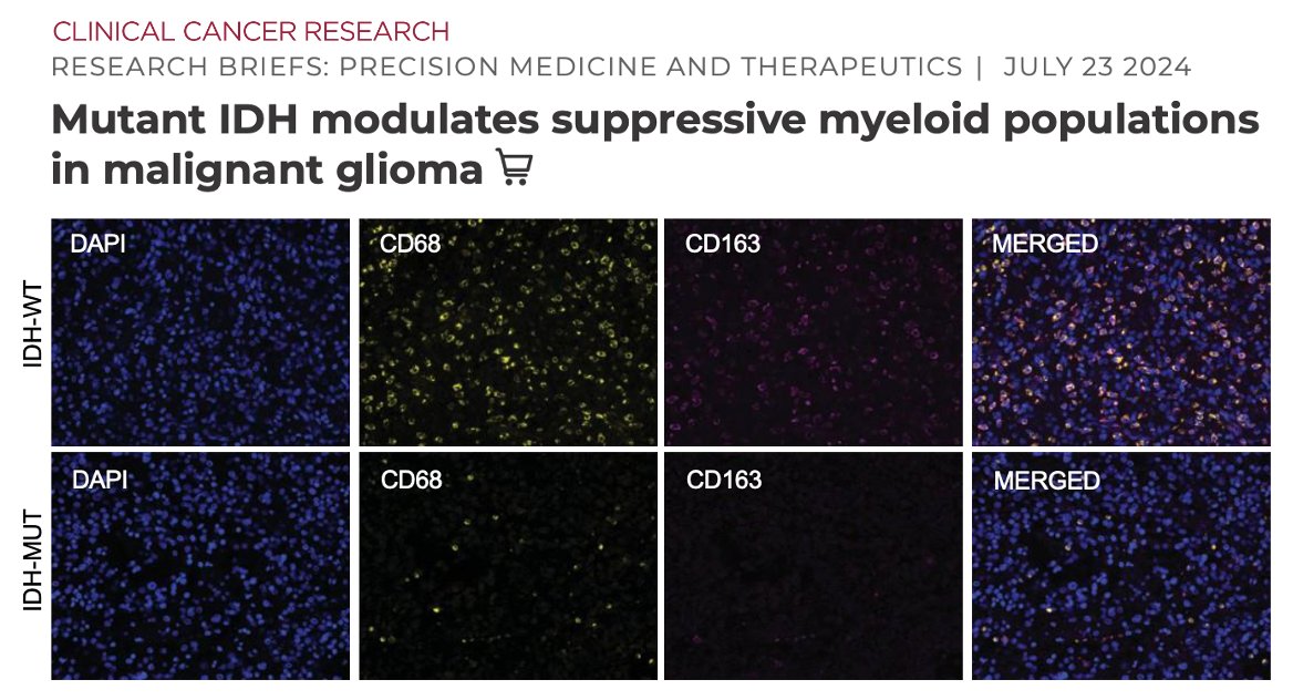Bryan D. Choi MD PhD (@bryandchoi) on Twitter photo Gliomas with IDH mutations have fewer suppressive myeloid cells, and may set the stage for cell therapy w/ #CARTcells. Awesome work <a href="/egrewal1/">Eric Grewal</a> <a href="/LGKRichardson/">Leland G. Richardson</a> published yesterday in <a href="/CCR_AACR/">Clinical Cancer Research</a>
<a href="/MGHNeurosurg/">MGH Neurosurgery</a> <a href="/MGBneurosurgery/">MGB Neurosurgery</a>
doi.org/10.1158/1078-0… Gliomas with IDH mutations have fewer suppressive myeloid cells, and may set the stage for cell therapy w/ #CARTcells. Awesome work <a href="/egrewal1/">Eric Grewal</a> <a href="/LGKRichardson/">Leland G. Richardson</a> published yesterday in <a href="/CCR_AACR/">Clinical Cancer Research</a>
<a href="/MGHNeurosurg/">MGH Neurosurgery</a> <a href="/MGBneurosurgery/">MGB Neurosurgery</a>
doi.org/10.1158/1078-0…