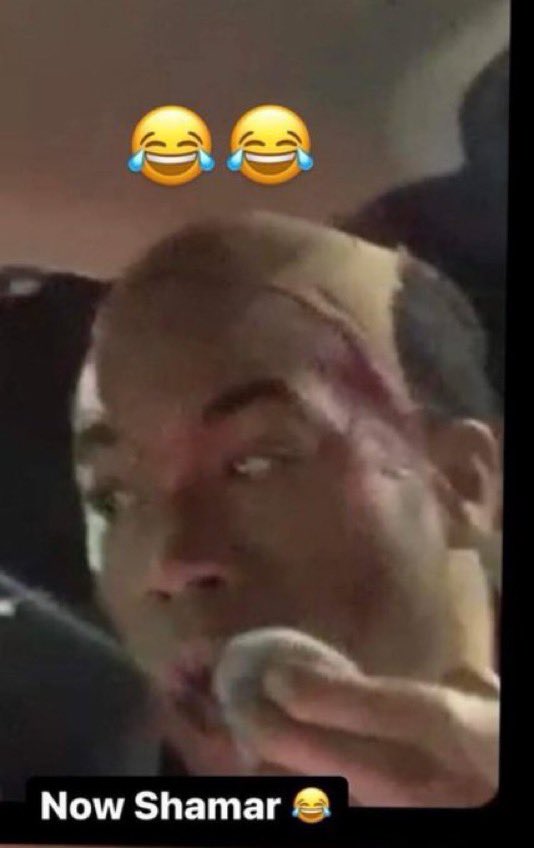 fightarchivex's tweet photo. Now Shamar😔😭😭💀

#boyfight #fight #Fighter #fightingvideos #hoodfight #streetfight #wildfight https://t.co/leKd1A2Ycz