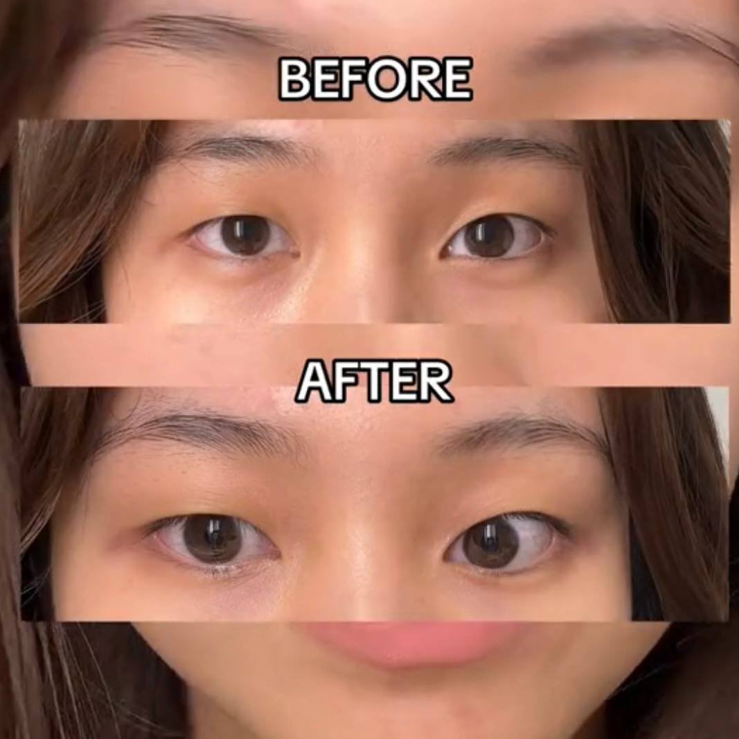bckupacc99's tweet photo. Jarang kan tengok idols ada dark circles even when they are bare face. 

Sebab diorang pakai benda ni laaa dark circle and eye bag tu tak pernah muncul.

This eye serum really live up to their hype sebab cepat betul boleh nampak result. https://t.co/g2721CaNAC