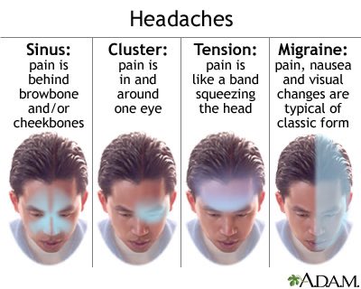 Nyeri kepala tuh ada banyak macemnya. Coba deh cek gambar! 

Kalian sendiri biasanya ngerasain jenis nyeri kepala yang mana? 😵‍💫🤕🤒