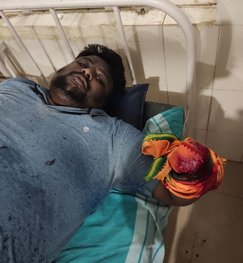 ambedkariteIND's tweet photo. #Casteism People of oppressive caste chopped off the hand of a Dalit youth. Incident happened in Karnataka. https://t.co/gRbgieO3DI